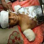 How many Iraqis died?